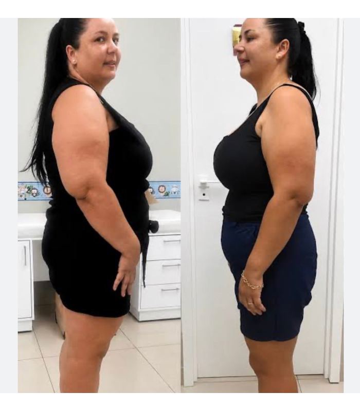 Resultado antes e depois